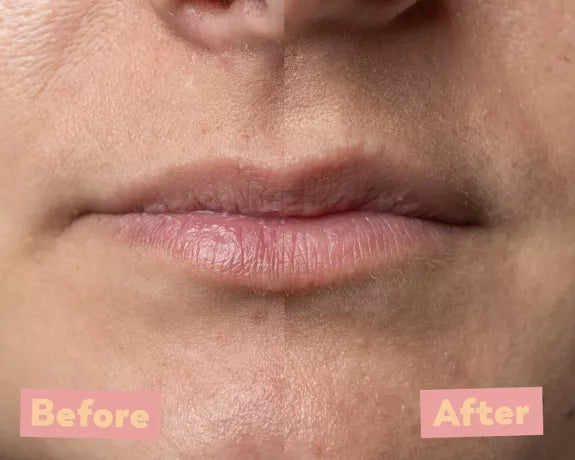 Lip Peel Green Apple - AHA 5% - Litterly
